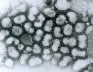Influenza A vírusok elektronmikroszkópos fényképe